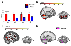 García et al. (2017). Ataxia action verbs - JMG