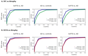 Moguilner 2020. Fluctuations